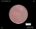 e.coli macconkey